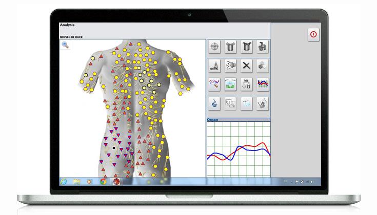 Bioresonance-a-Ennery-2